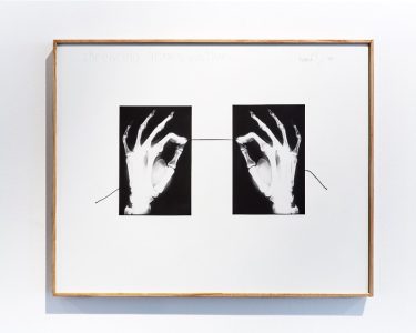 Framed artwork showing two X-ray images of hands with fingers forming a circle, connected by a thin straight line across a white background.