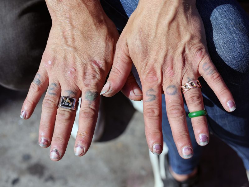 Two hands with visible tattoos on the fingers, worn nail polish, several rings, and some skin blemishes, shown resting on jeans.