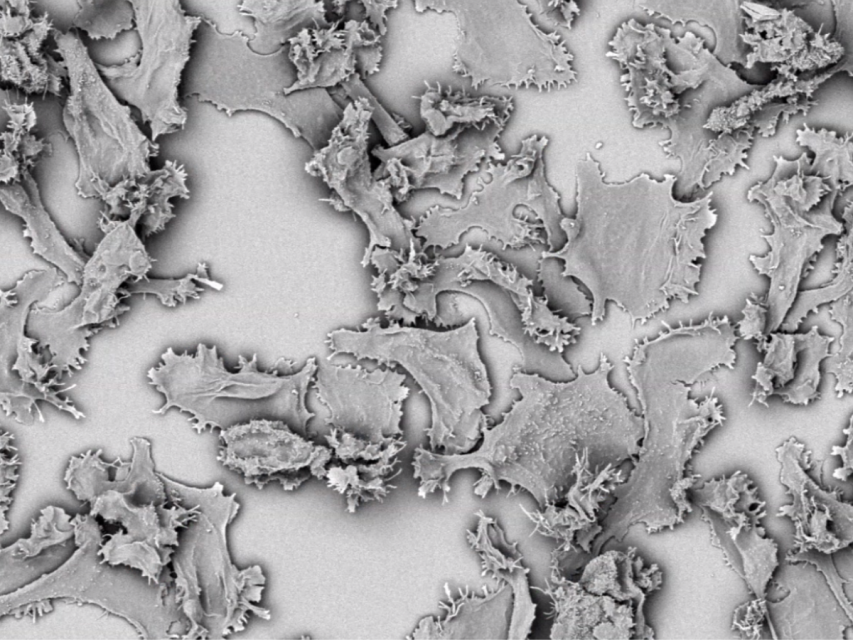 Scanning electron microscope image showing irregular, jagged fragments of material scattered across a flat surface.
