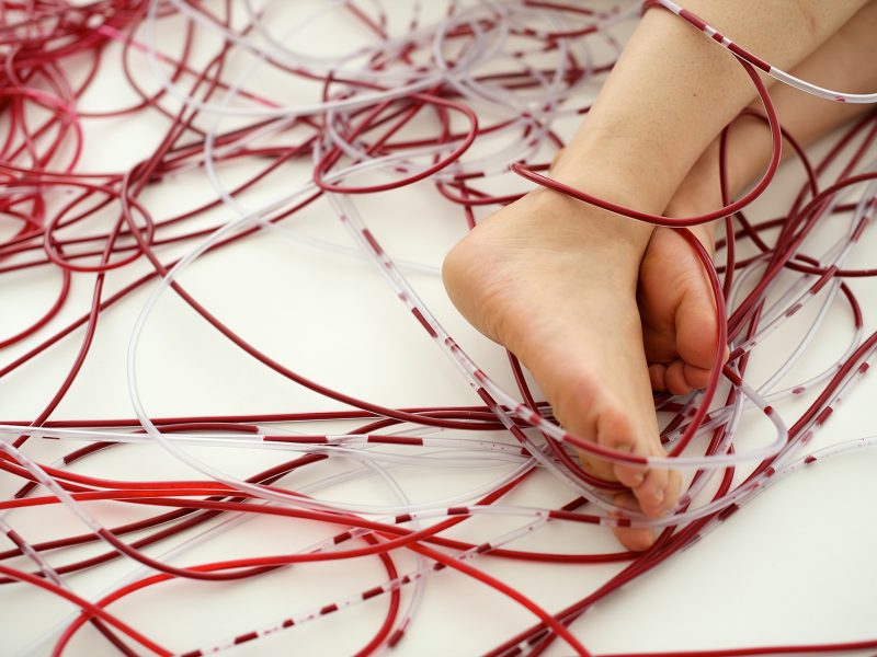 Bare feet resting on a white surface surrounded by tangled red and clear plastic tubes.