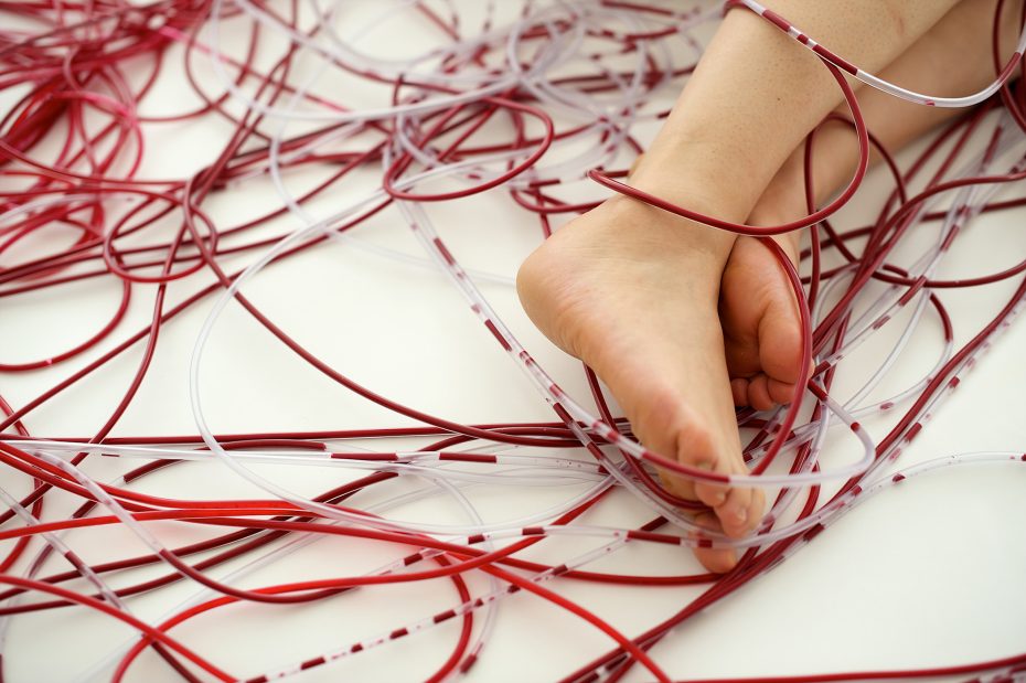 Bare feet rest on a white surface surrounded by a tangle of red and clear plastic tubes.