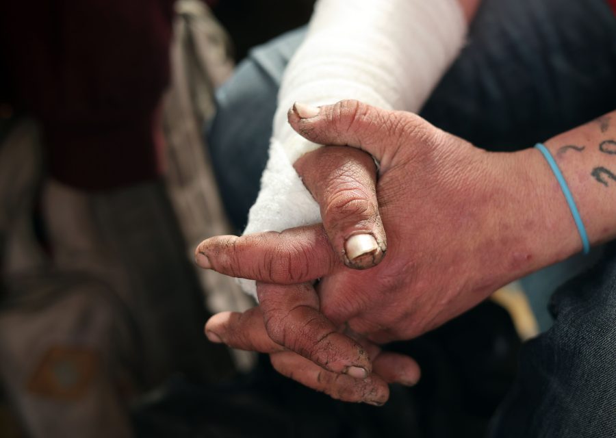 Close-up of a person’s dirty hands with chipped nails, one arm wrapped in a white bandage, and a blue jail wristband visible.