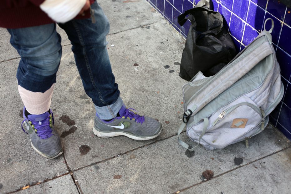 A person with a bandaged leg and purple-laced sneakers stands on a sidewalk next to a gray backpack and a black bag, near a blue-tiled wall.